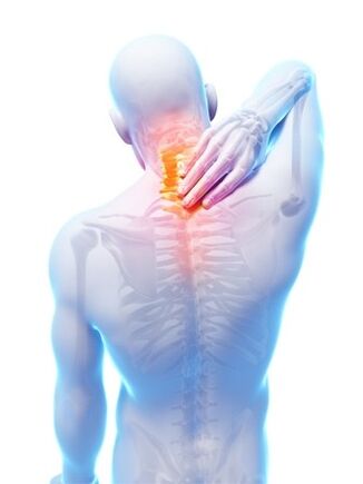 Spinální osteochondróza, při které je Hondrocream nepostradatelný