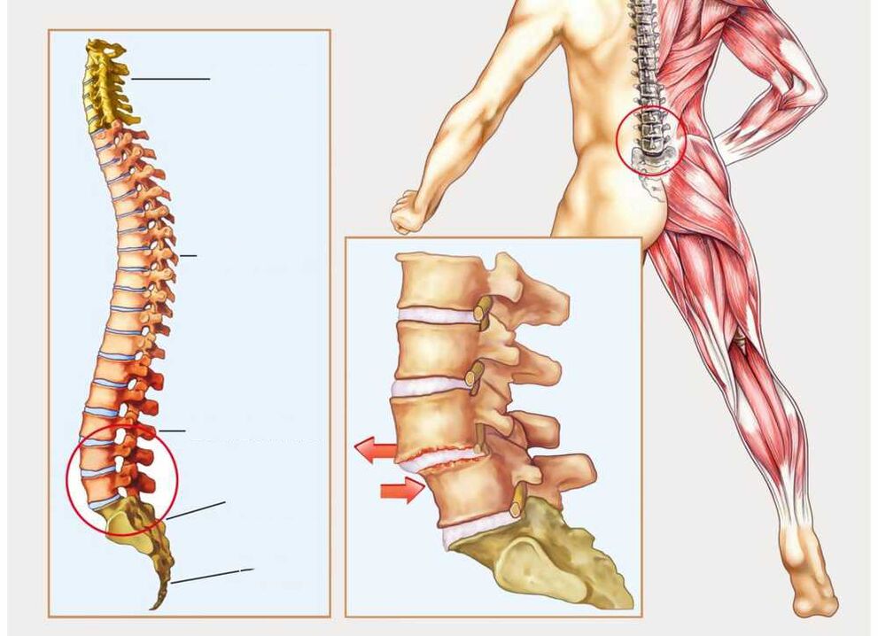 zdravá i nemocná páteř
