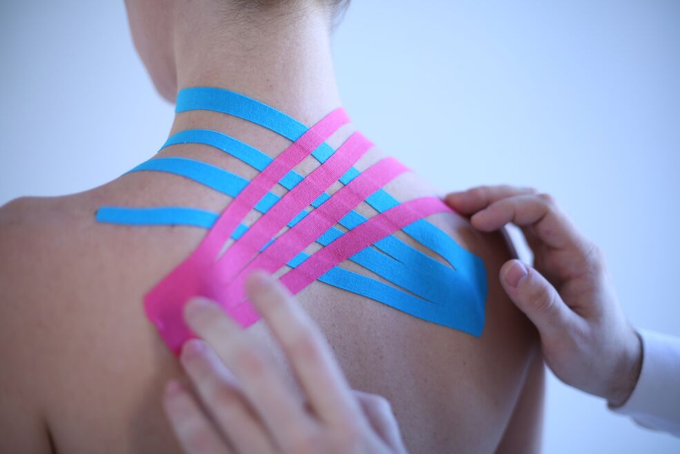 kinesiotaping pro spinální osteochondrózu