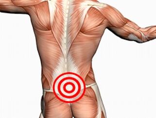 Osteochondróza bederní páteře