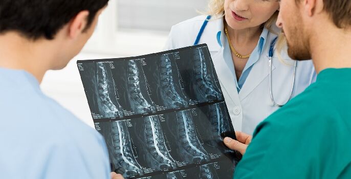 Rentgen páteře jako způsob diagnostiky osteochondrózy