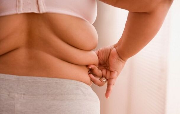 nadváha, příčina cervikální osteochondrózy u žen mladších 40 let